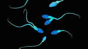 Tratospermie : dfinition, causes et traitements  Imane Harmonie
