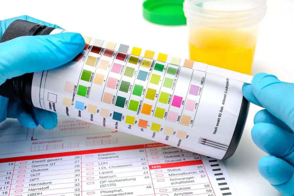 Test ph glaire cervicale acide