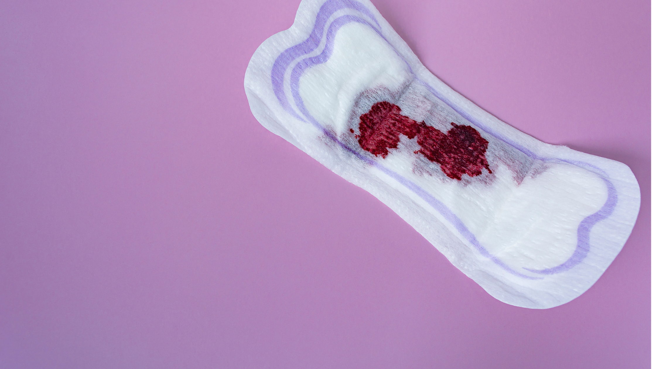 Saignement d’ovulation : est-ce normal ?